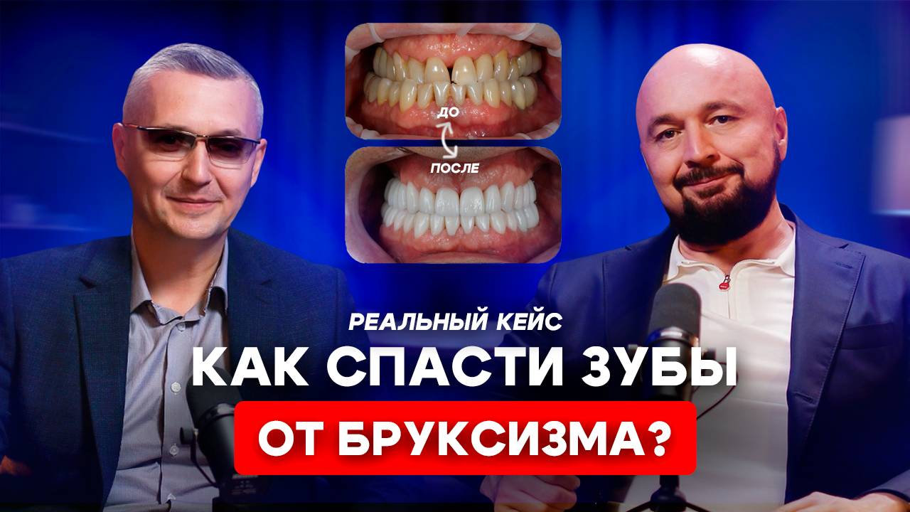 Сложные случаи из нашей практики. Лечение неправильного прикуса и стираемости зубов
