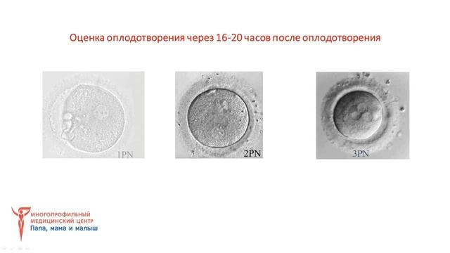 Эмбриологический этап программы ЭКО