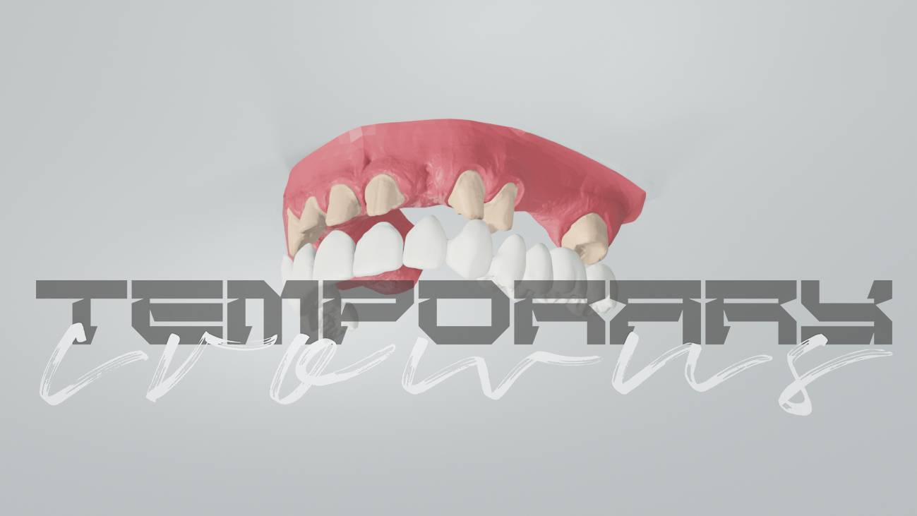 Temporary crowns animation