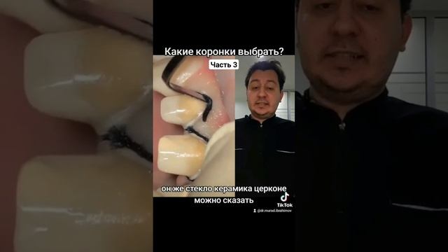 Какие короннки выбрать? Ч3 #стоматолог #стоматология #коронки #металлокерамика #циркон #коронканазу