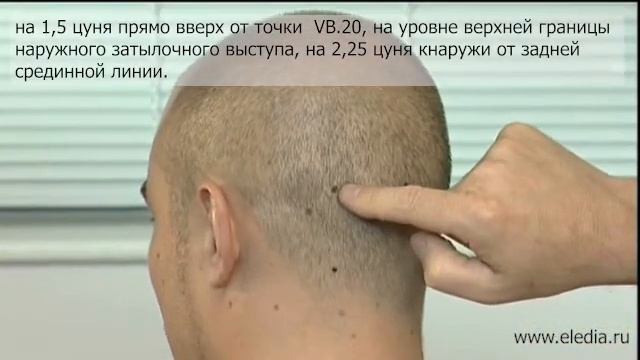 Энцефалит