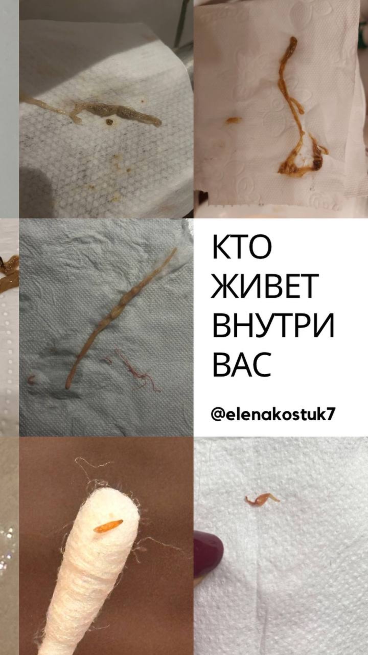 КТО ЖИВЕТ ВНУТРИ ВАС😱? ВЫ ПРОВЕРЯЛИ🪱?