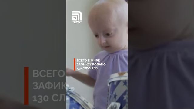 Звезда Tiktok умерла в 19 лет из-за преждевременного старения