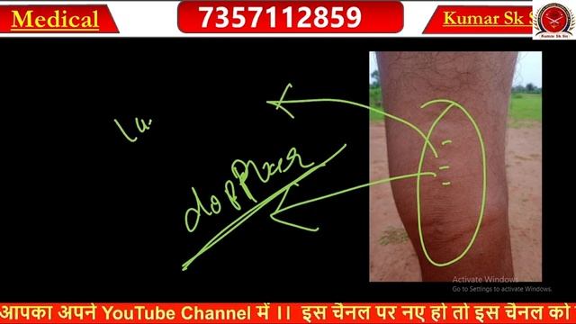 Medical Unfit Points | Exercises | SSC GD 2024 | SSB Tradesman2023 | crpf tradesman @KumarSkSir  31