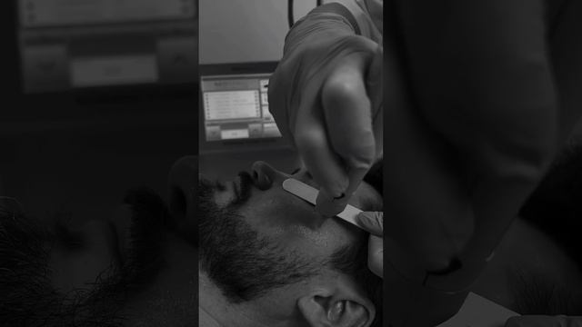 Мужская косметология в KallistoMed Красивую и здоровую кожу хотят не только женщины! #косметология