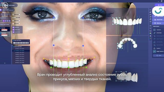 Цифровая диагностика SmileVR: ожидания от лечения совпадут с реальностью!