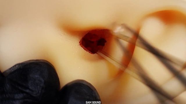ASMR 당신의 팅글과 상상력을 자극하는 딱딱하고 딱딱한데 소리는 또 완전 좋은 왕딱딱한 귀지 제거👍재미와 시각적팅글 업업!!Tingle ear cleaning No talkin