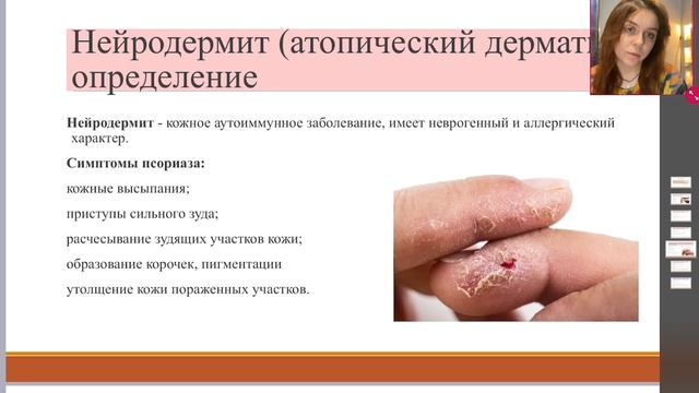 Психосоматика: кожные заболевания. Псориаз и нейродермит