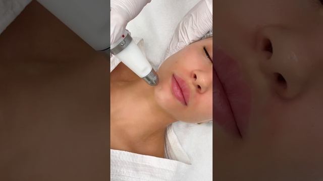 Dermadrop — технология которая доставляет гиалуроновую кислоту в глубокие слои кожи без инъекций ✔️