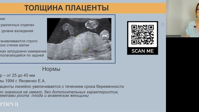 3.3 Лекция. Осмотр плаценты и околоплодных вод