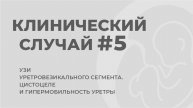 Клинический случай. Разбор на кинопетле. Гипермобильность уретры и цистоцеле.