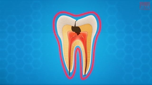 Мультик про здоровье зубов ЗАДАЧА ПО ЗУБАМ «Команда Познавалова»
