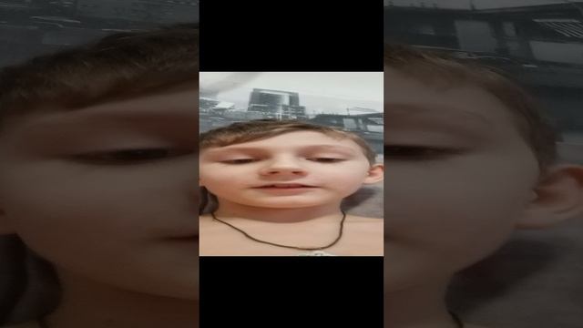 Я спалил свою лицо!!!!