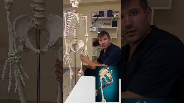Как быстро снять боль в паху и бедре без таблеток! https://t.me/skipin_therapeia