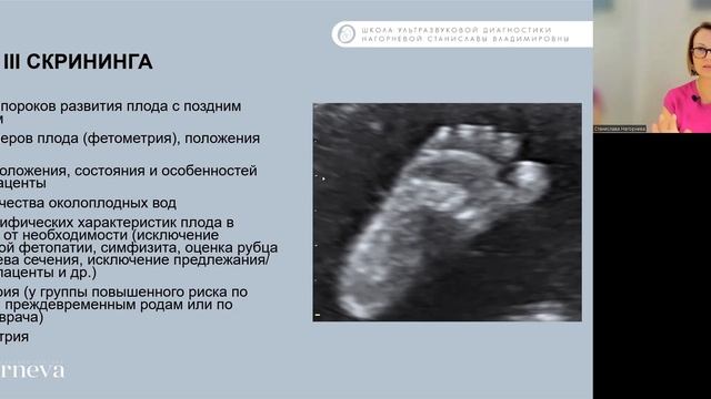 4.1 Лекция. Дискуссионные вопросы, связанные с проведением 3 скрининга