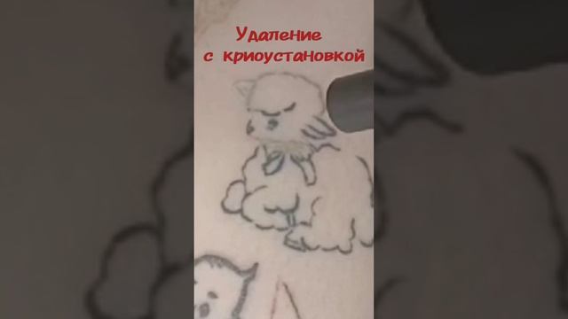 Удаление тату