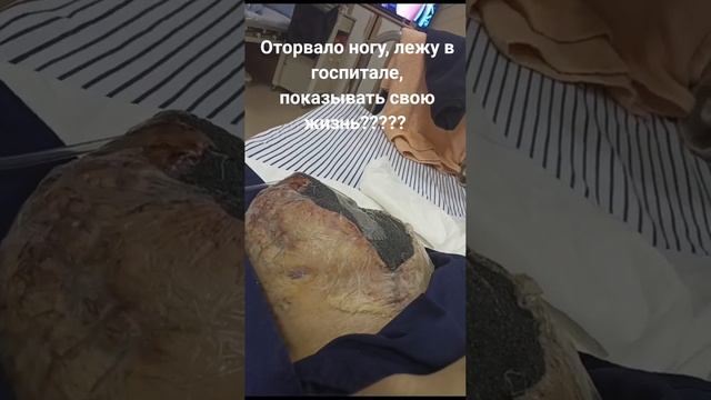 Хочу показывать свою новую жизнь после СВО. Ребят нужна ваша поддержка