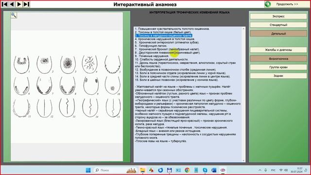 2024-07-30_120401-ПО Дианел®-2.1. обучение, Анамнез при повторном тесте, Физиогномика подробно