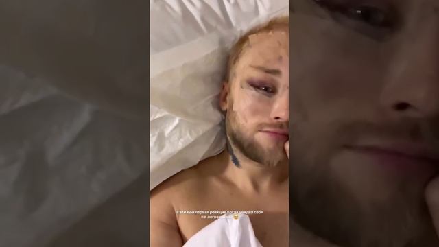 Егор Холявин после пластической операции 🤕😳