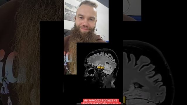 Нано чипы в снигерсах, бананах заменяют вакцинирование. Коварный план Билла Гейца