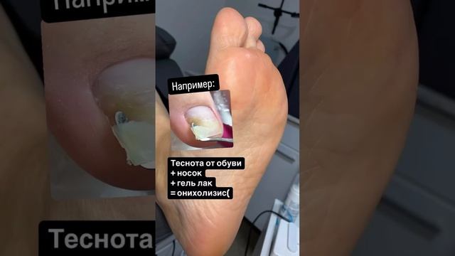 Снимаем на зиму гель лак? Или делаем пленки? #педикюр #nailart #nails #дизайнногтей #пленки #ногти