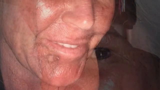 Elaine Brennan Skin Renewal Peel