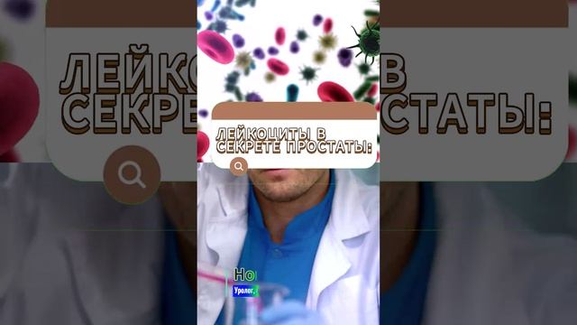 Простатит. Секрет простаты - сколько лейкоцитов? #простатит