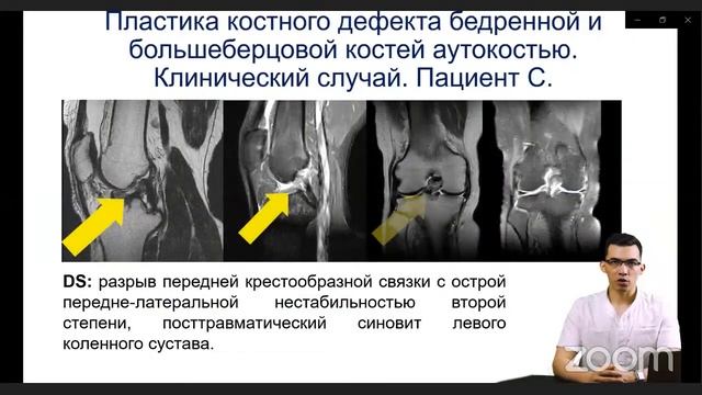 №1 Секция молодых ученых: актуальные проблемы общей патофизиологии
