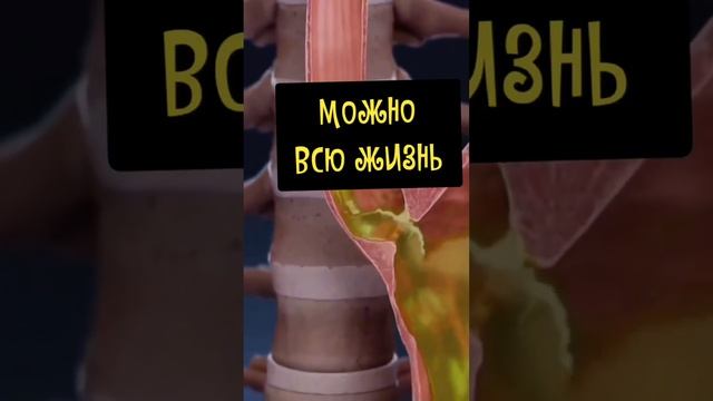 Изжога и рефлюкс больше не проблема: раскроем секреты здорового желудка