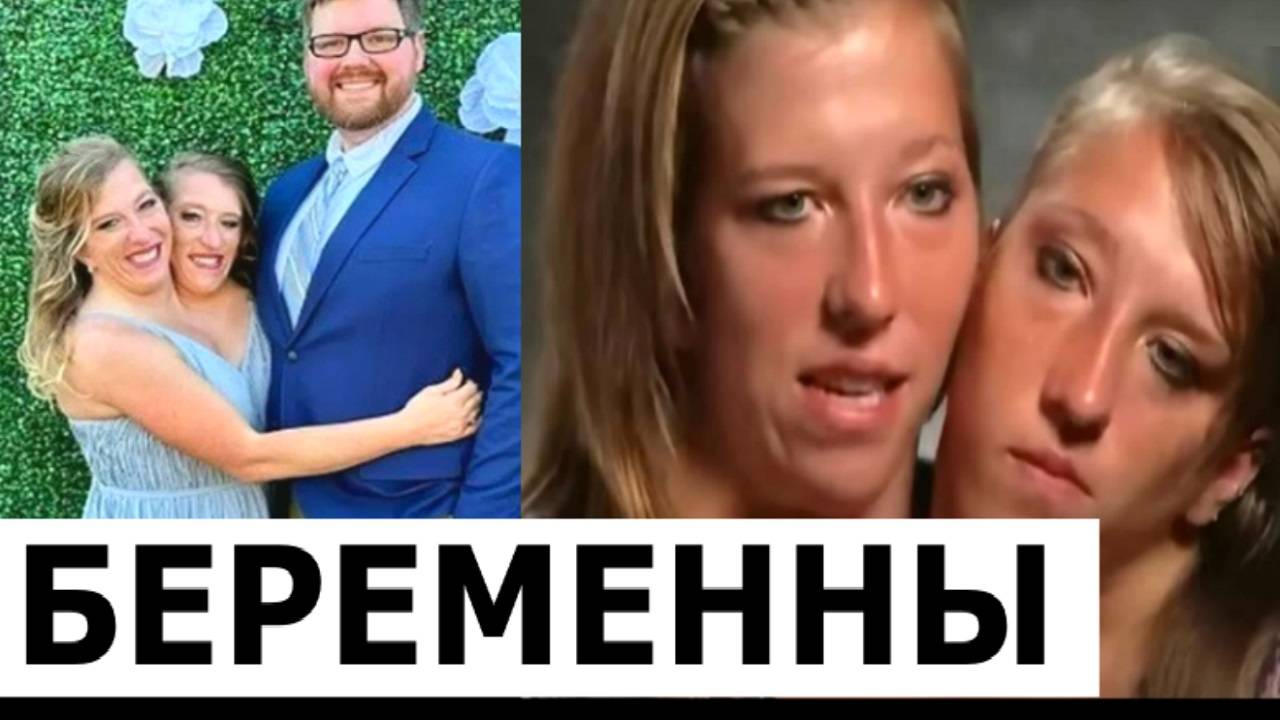 Двухголовые Сиамские Близнецы Эбигейл и Бриттани забеременели