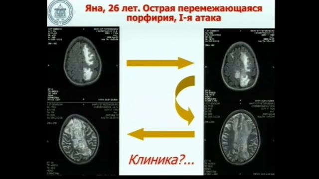 Физиология нервной системы Лебединский К.М.