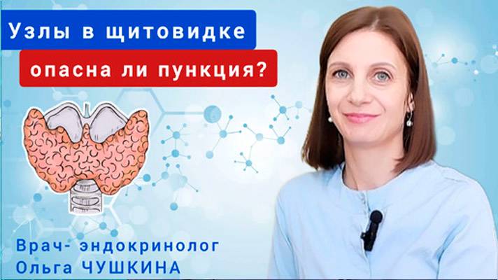 Узлы в щитовидке_ что будут смотреть и опасна ли пункция_