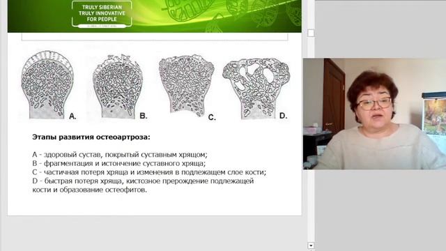 Гулюза про суставы