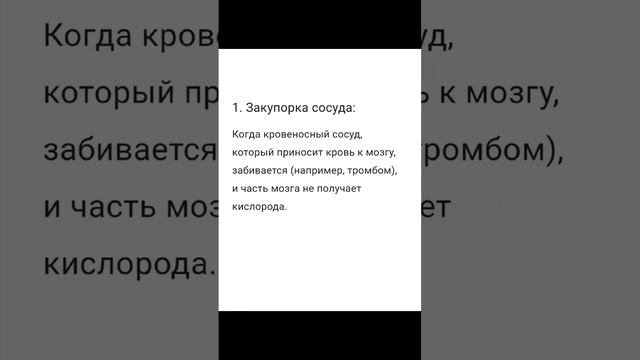 Просто об инсульте