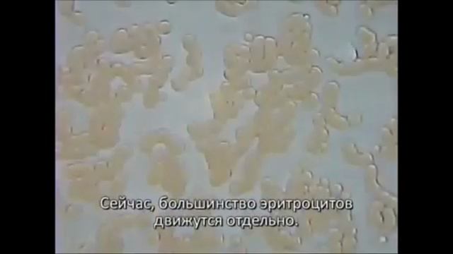 «Пьяная» и «трезвая» крови под микроскопом