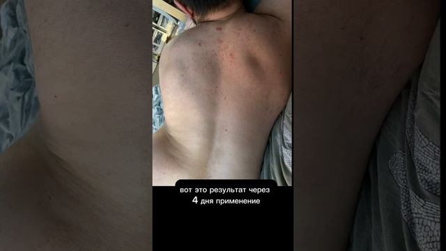 Все кожные заболевания живут не на коже. По вопросам пишите на вотсап/тг 79109053539
