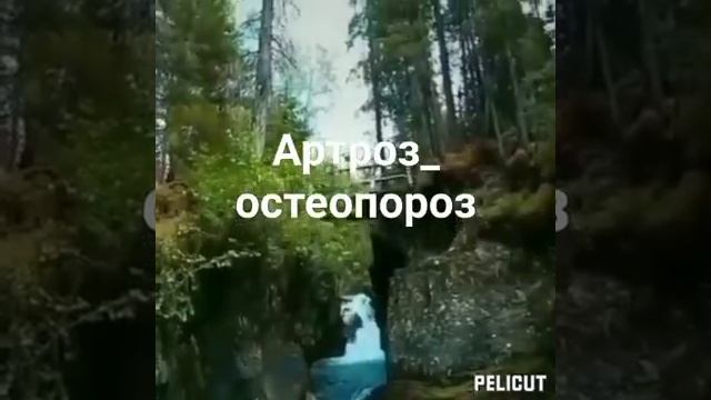 Артроз остеопороз