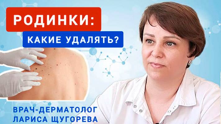 Какие родинки нужно удалять, а какие не опасны ?