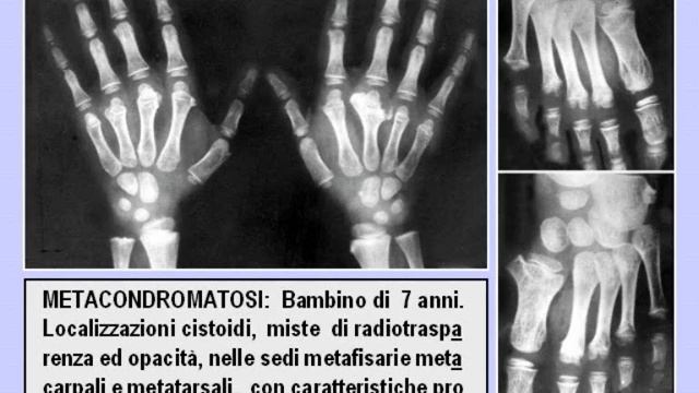 Z29 osteopatie da sviluppo tissutale anarchico 1 178