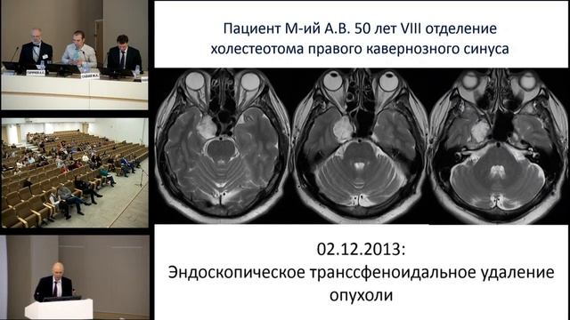 Нозокомиальный менингит в нейрохирургической клинике Савин И.А. 22.04.17