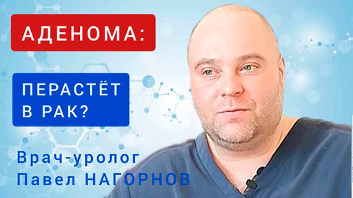 Перерастёт ли аденома в рак? Что будет с эректильной функцией  Рассказывает врач-уролог