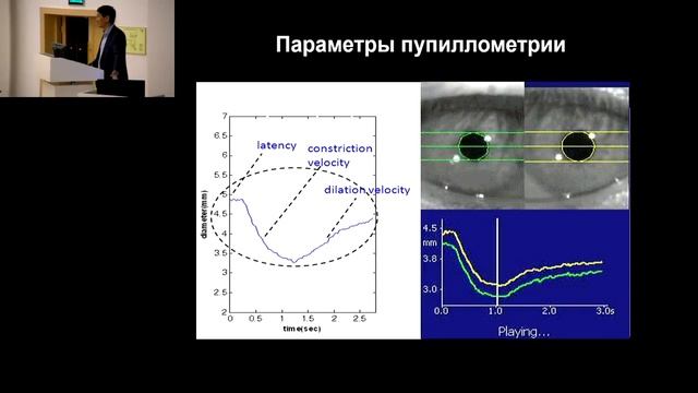 Мониторинг фотореакции пупилометрия в нейрореанимации Ошоров А.В 2017