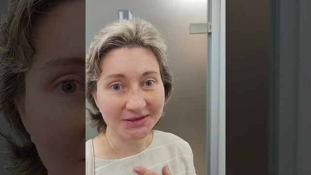 Снимаем гипс. Неделя после риносептопластики.