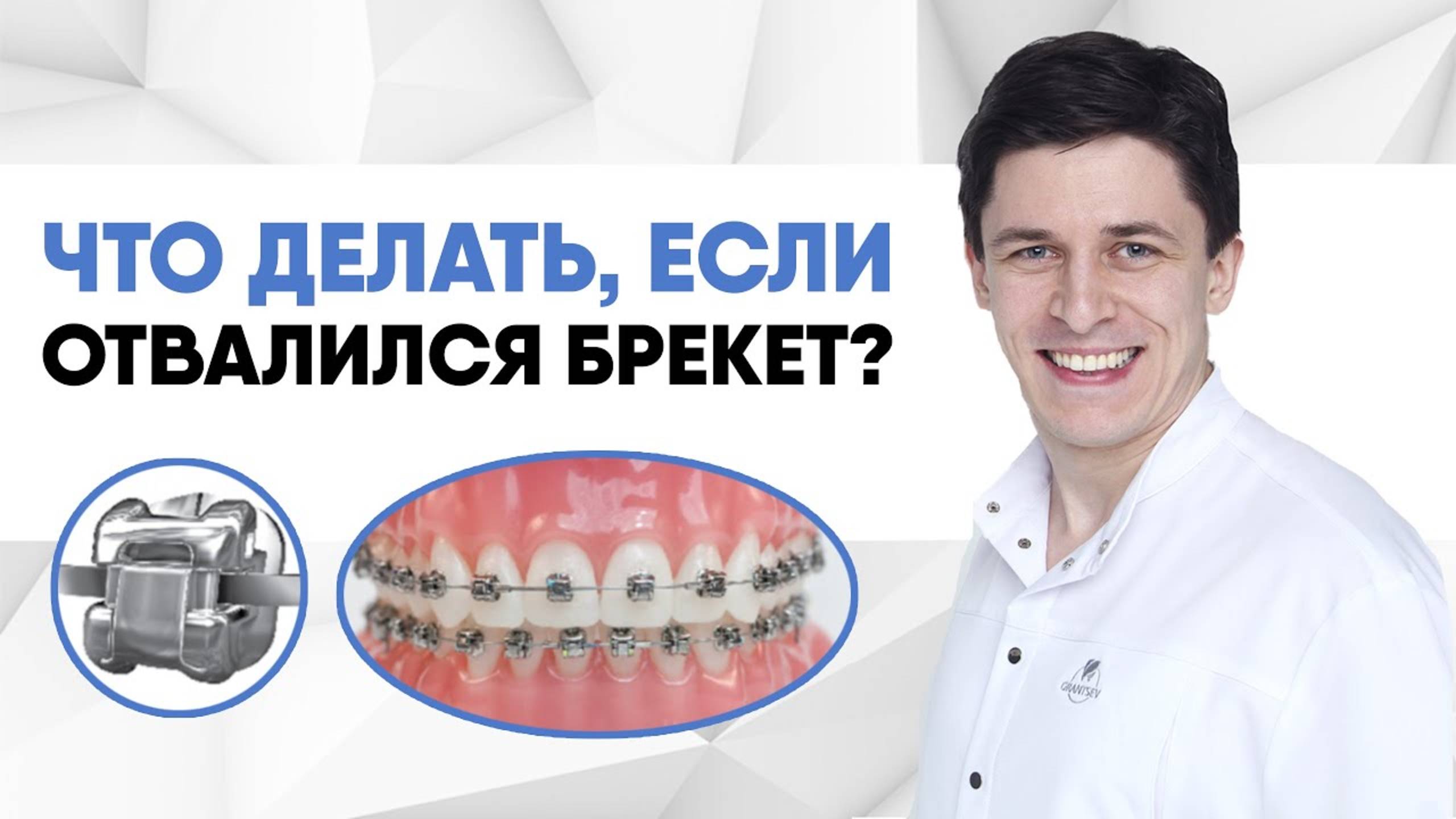 отвалился брекет