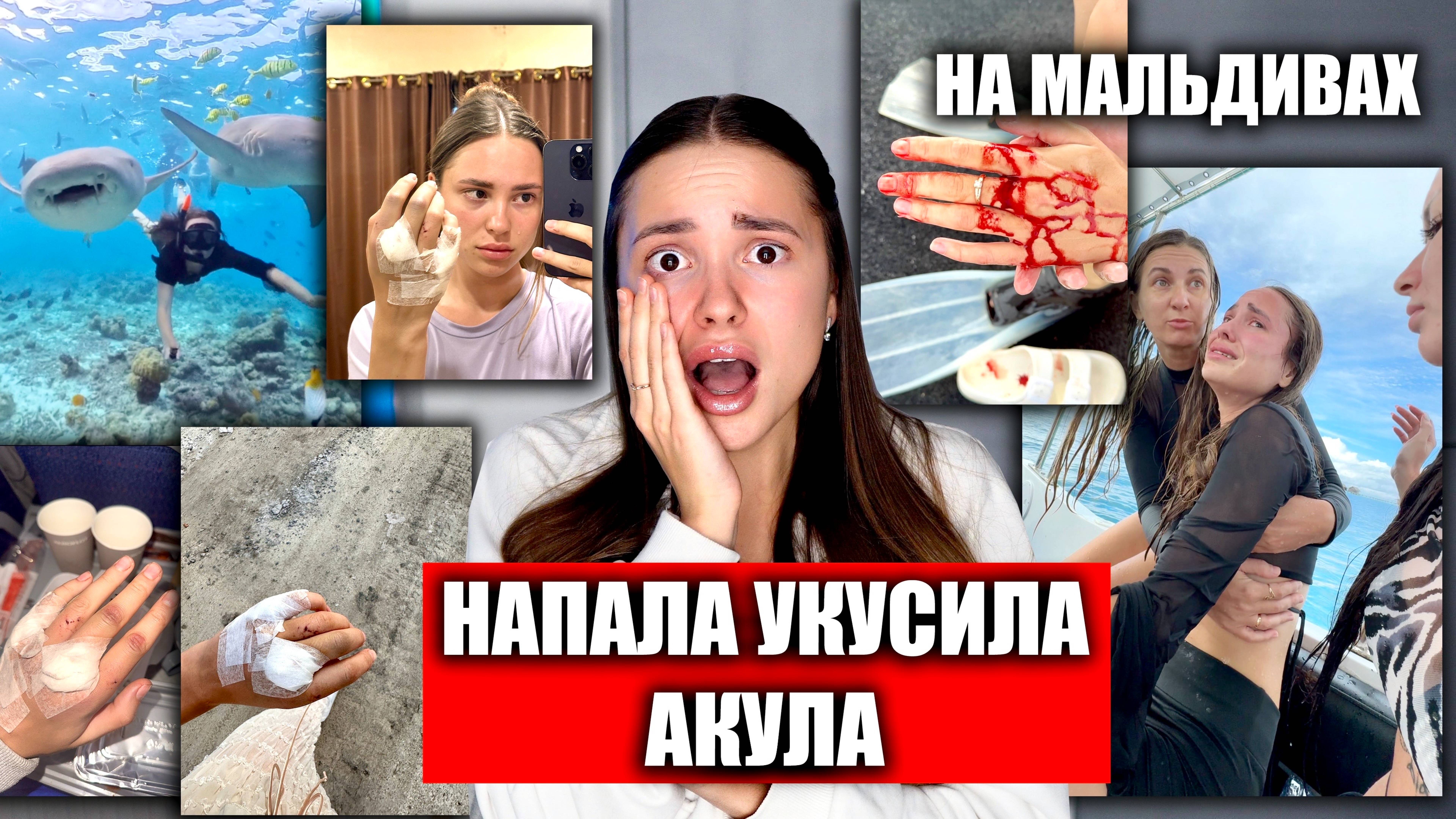 На Меня НАПАЛА и УКУСИЛА АКУЛА. СТРАШНЫЕ КАДРЫ!! Акула нянька на Мальдивах