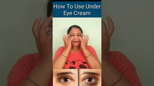 How To Remove Under Eye Circle || Best Undereye Cream || #shorts