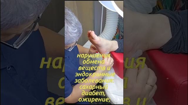 Трещины.mp4