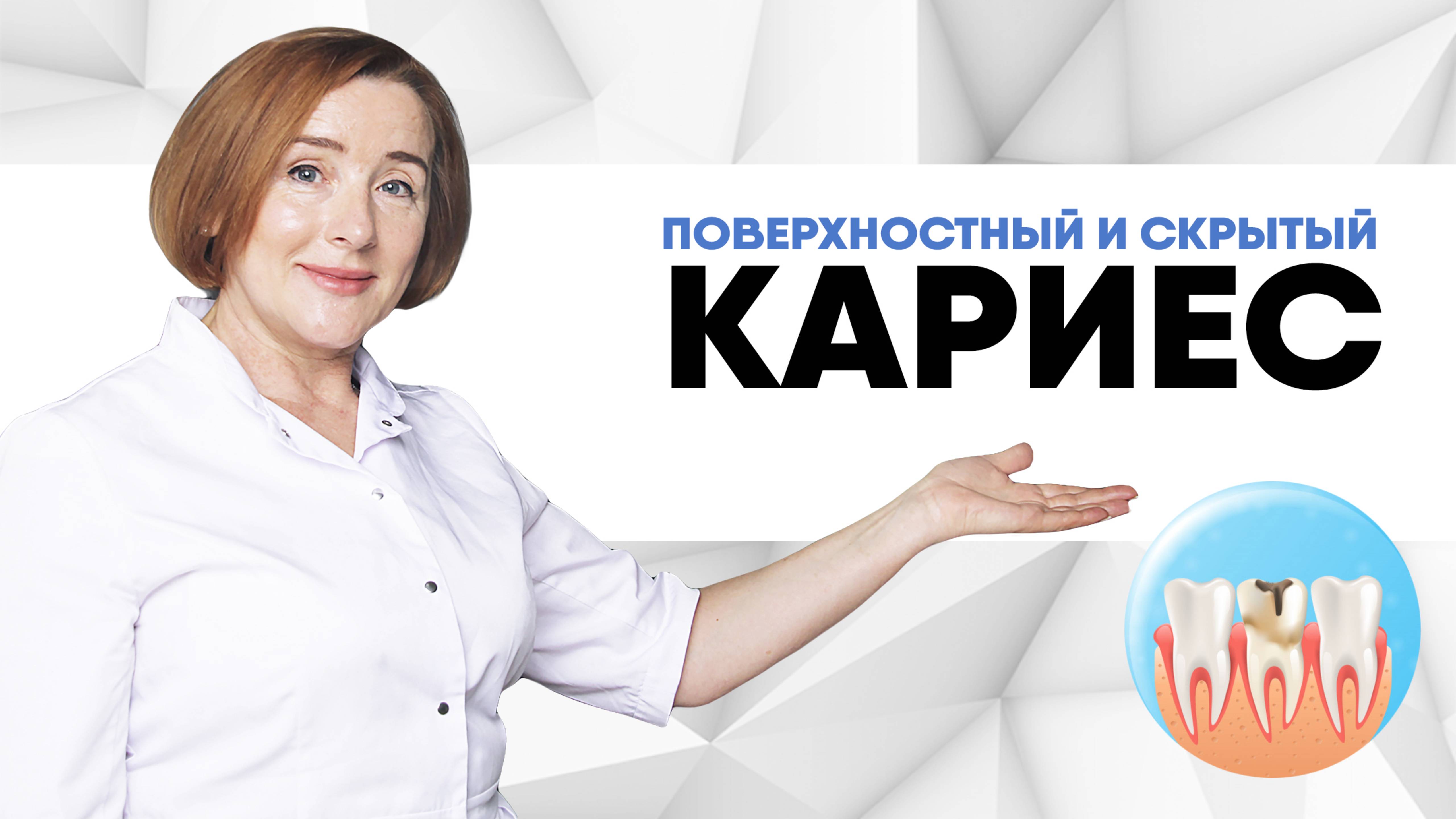Как избавиться от кариеса? Поверхностный и скрытый кариес.Что делать, если болит зуб?