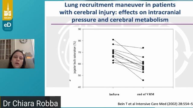 How to ventilate  brain injury C Robba