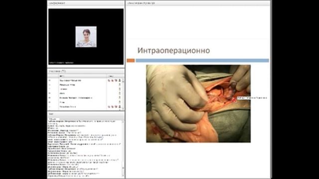 Необычные УЗ находки, разбор клинических случаев. Имберт Габриела #убвк_инструментальная_диагностика